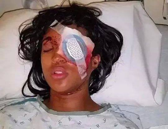 Woman blinded after officer shot bean bag round at car in Ferguson